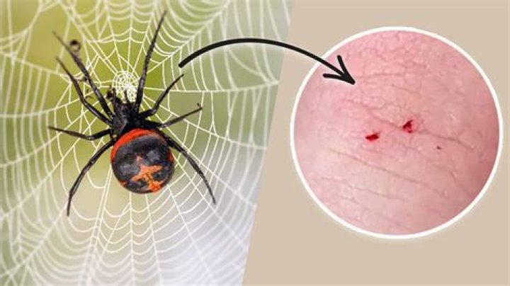 Can Spiders Leave Their Fangs In You? Separating Fact from Fear