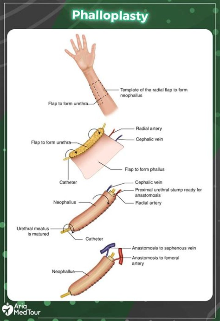 Did Jules Have Bottom Surgery? Unpacking Identity and Digital Connection