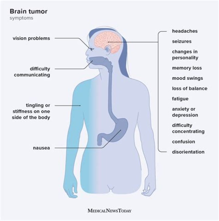 Did Shannon Bream's Husband Have a Brain Tumor? Unpacking a Personal Health Journey
