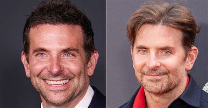 Did Shannon Have a Facelift? Unpacking Public Appearance Questions