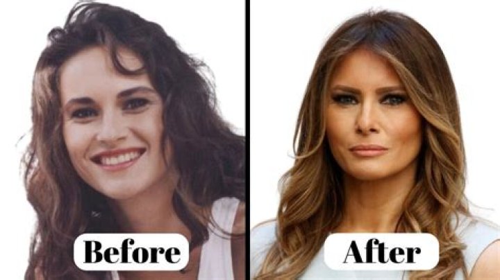 How Many Face Surgeries Has Jennifer Lopez Had? Unpacking the Ageless Glow