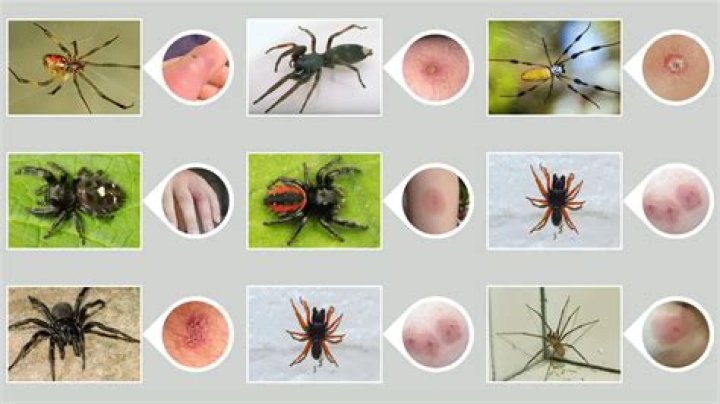 Identifying Spider Bites: What Does a Spider Fang Bite Look Like?