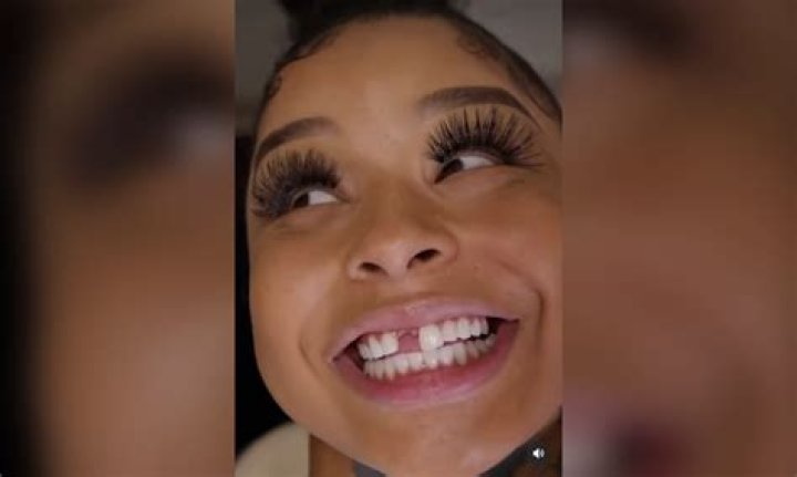 What Happened to Chrisean's Tooth? Exploring Public Curiosity About a Celebrity Smile