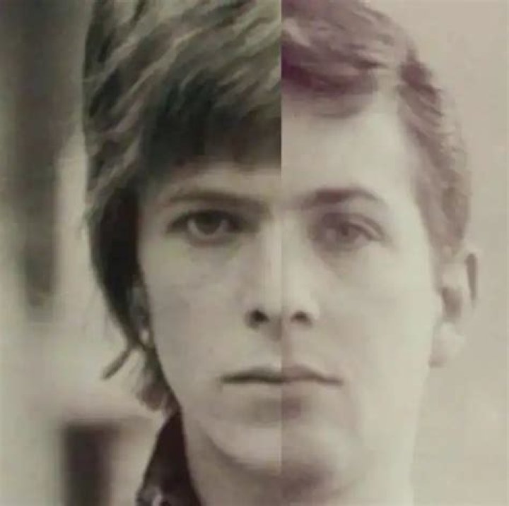 What Happened to David Bowie's Half Brother? Uncovering Terry Burns' Story